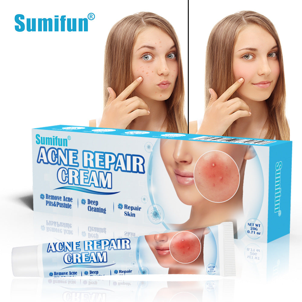 Anti-acne herstellende crème